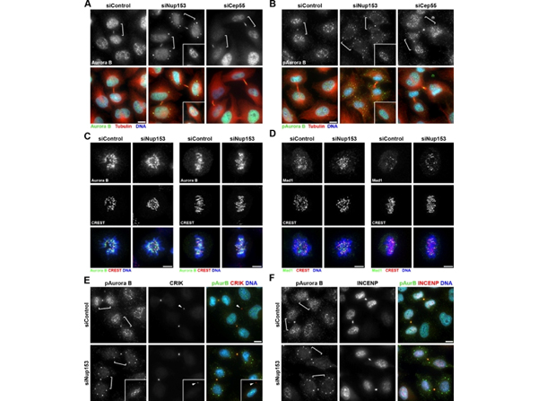 Immunofluorescence using Aurora B pT232
